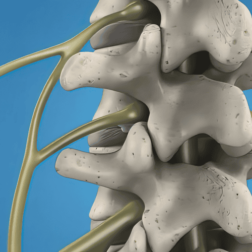 Tratamiento de la escoliosis en Turquía: causas, síntomas y procedimientos